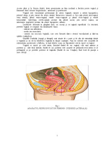 Sarcina Extrauterină - Pagina 5