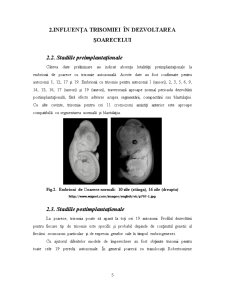 Trisomia autozomal[ la șoarece - Pagina 5