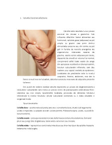 Preparate Cosmetice Anticelulitice - Pagina 2