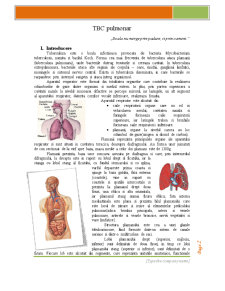 TBC Pulmonar - Pagina 1