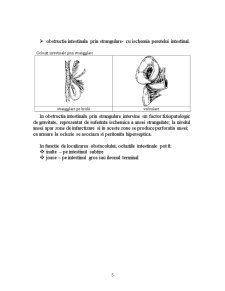 Ocluzia intestinală - Pagina 5