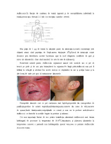 Staphylococcus Aureus - Pagina 5