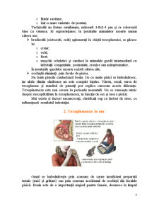 Toxoplasmoză - Pagina 4