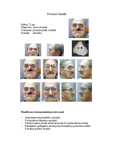 Generalități - protezare maxilo-facială - Pagina 4