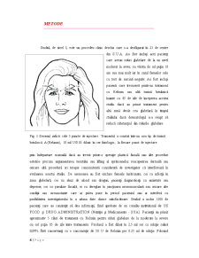 Toxina Botulinică - Pagina 4