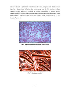 Evoluția Tuberculozei Bovine în Marea Britanie în Perioada 2007-2010 - Pagina 5