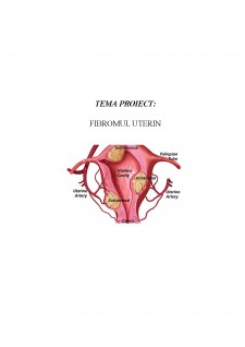 Îngrijirea pacientei cu fibrom uterin - Pagina 1