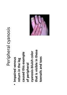 Medical semiology - Pagina 167