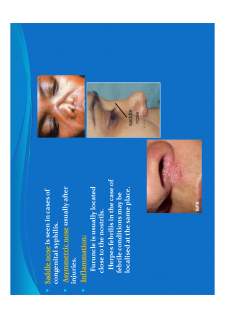 Medical semiology - Pagina 313