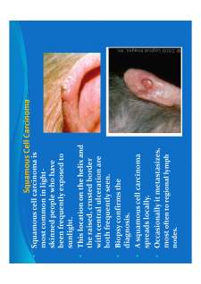 Medical semiology - Pagina 318