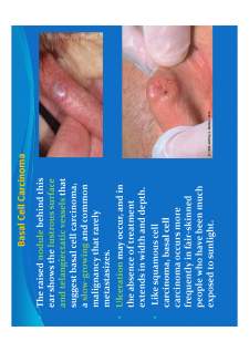 Medical semiology - Pagina 319
