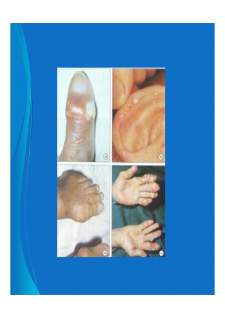 Medical semiology - Pagina 321