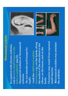 Medical semiology - Pagina 322
