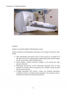 SRS - Radiochirurgia stereotactica - Pagina 5