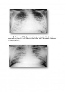 Bronhopneumonia - Pagina 4