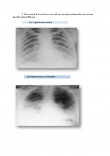 Bronhopneumonia - Pagina 5