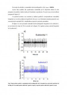 Înregistrarea automată a unui semnal electrocardiografic - Pagina 2