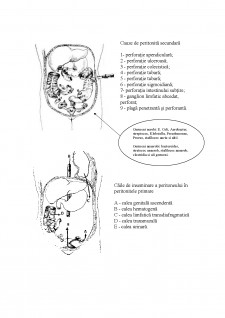 Peritonitele - Pagina 2