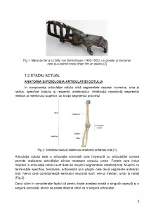 Proiectarea și realizarea unei proteze de cot - Pagina 4