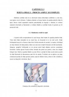 Studiu privind metodele de igienizare orală în rândul pacienților cu lucrări protetice - Pagina 2