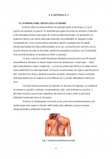 Importanța kinetoterapiei în corectarea tulburărilor de statică vertebrală - scolioză - Pagina 4