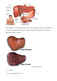 Ciroză hepatică - Pagina 1