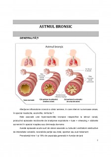 Astmul bronsic - Pagina 2