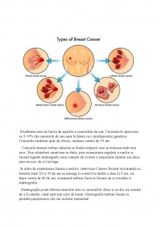 Rolul alimentației în prevenirea cancerului mamar - Pagina 4