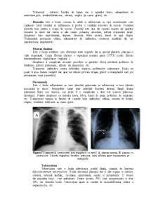 Sistemul Respirator - Pagina 4