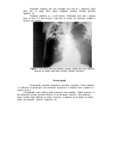 Sistemul Respirator - Pagina 5