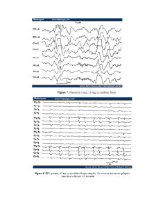Electroencefalograma - Pagina 4