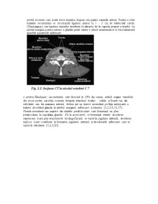 Patologia Chirurgicală a Tiroidei - Pagina 4