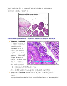 Cancerul Uterin - Pagina 4