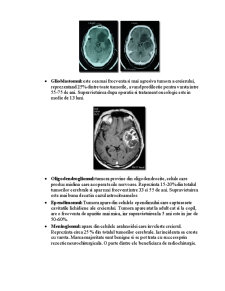 Tumorile Sistemului Nervos - Pagina 2