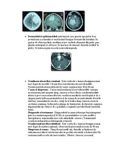 Tumorile Sistemului Nervos - Pagina 3