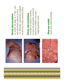 Ciroza hepatică - Pagina 2