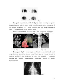 Diagnosticul imagistic al aparatului respirator - Pagina 2