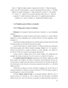 Industrializarea Primară a Lemnului - Pagina 61