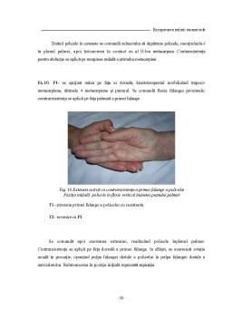 Licență - Recuperarea Mâinii Reumatoide