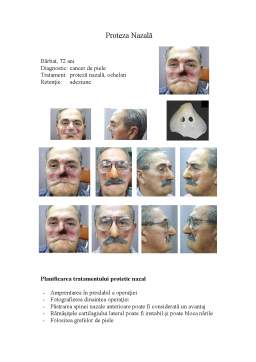 Referat - Generalități - protezare maxilo-facială