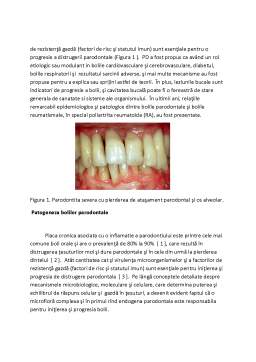 Referat - Asocierea dintre poliartrită reumatoidă și boli parodontale