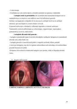 Licență - Îngrijirea pacientului cu inflamații ale corzilor vocale