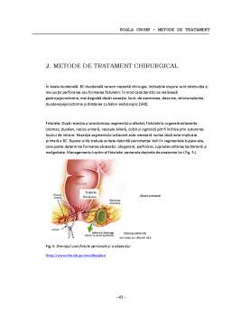 Referat - Boala Crohn - Metode de Tratament