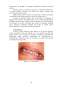 Sarcina și patologia buco-dentară - implicații