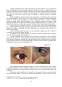 Îngrijirea Pacientului cu Afecțiuni ale Inflamațiilor și Infecțiilor Ochiului