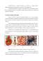Proiect - Aplicații biomedicale ale chitosanului