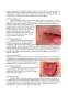 Leziunile intravasculare difuze - manifestări orale datorate hipovitaminozelor